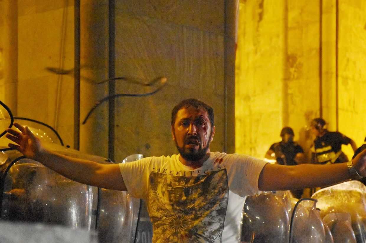 An injured protester during the 2019 Gavrilov’s night protests. Photo: Mariam Nikuradze/OC Media.